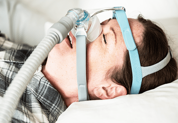 睡眠時無呼吸症候群の治療